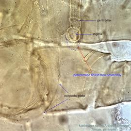  Fig. 15.  Melichares  sp. (ex  Artibeus cinereus ) female peritreme and exopodal plate. 