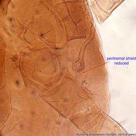  Fig. 4.  Hunteria brasiliensis  holotype female, ventral view showing reduced peritremal shield. 