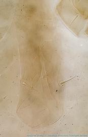  Fig. 4.  Stevelus amiculus  holotype female epigynal shield, ventral view. 
