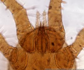  Fig. 6.  Dinogamasus  sp. (ex  Xylocopa aestuans ) female ventral gnathosoma. 