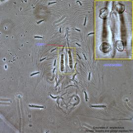  Fig. 5.  Ereynetes  cf.  amplectorus  female ovipore and genital papillae. 