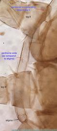  Fig. 5.  Stevelus amiculus  holotype female peritreme, ventral view. 