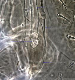  Fig. 6.  Neocypholaelaps  sp. female peritreme. 