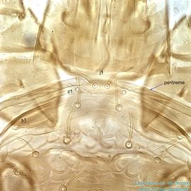  Fig. 6.  Lasioseius  sp. female peritremes, anterodorsal idiosoma. 