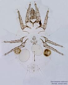  Fig. 6.  Sancassania rodionovi  female, dorsal view. 