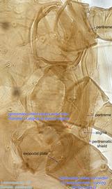  Fig. 7.  Lasioseius  sp. female ventral idiosoma showing peritreme. 