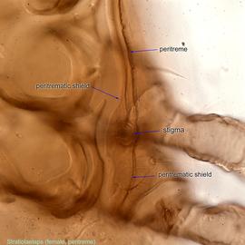  Fig. 7.  Stratiolaelaps  sp. female peritreme. 