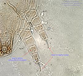  Fig. 8.  Medeus ithacaensis  holotype phoretic deutonymph legs III-IV, ventral view. 