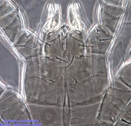  Fig. 8.  Spadiseius spathiphyllae  paratype female gnathosoma; phase contrast. 