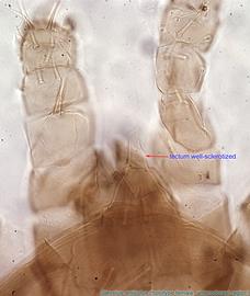  Fig. 9.  Stevelus amiculus  holotype female dorsal gnathosoma showing tectum. 