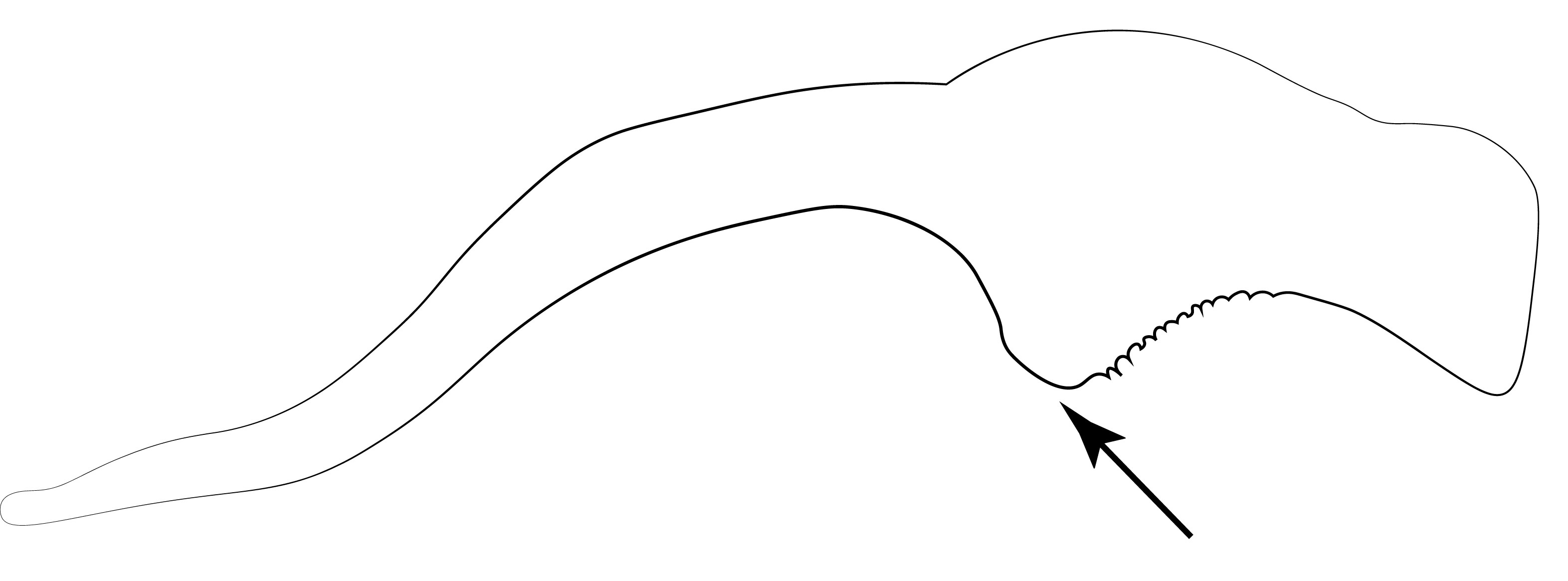 Penial sclerite after Hedqvist (1967: fig. 3B). Proximoventral corner of valviceps marked with arrow.