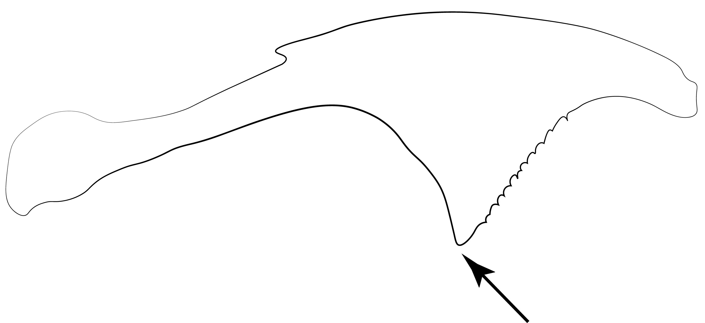 Penial sclerite after Hedqvist (1967: fig. 3C). Proximoventral corner of valviceps marked with arrow.