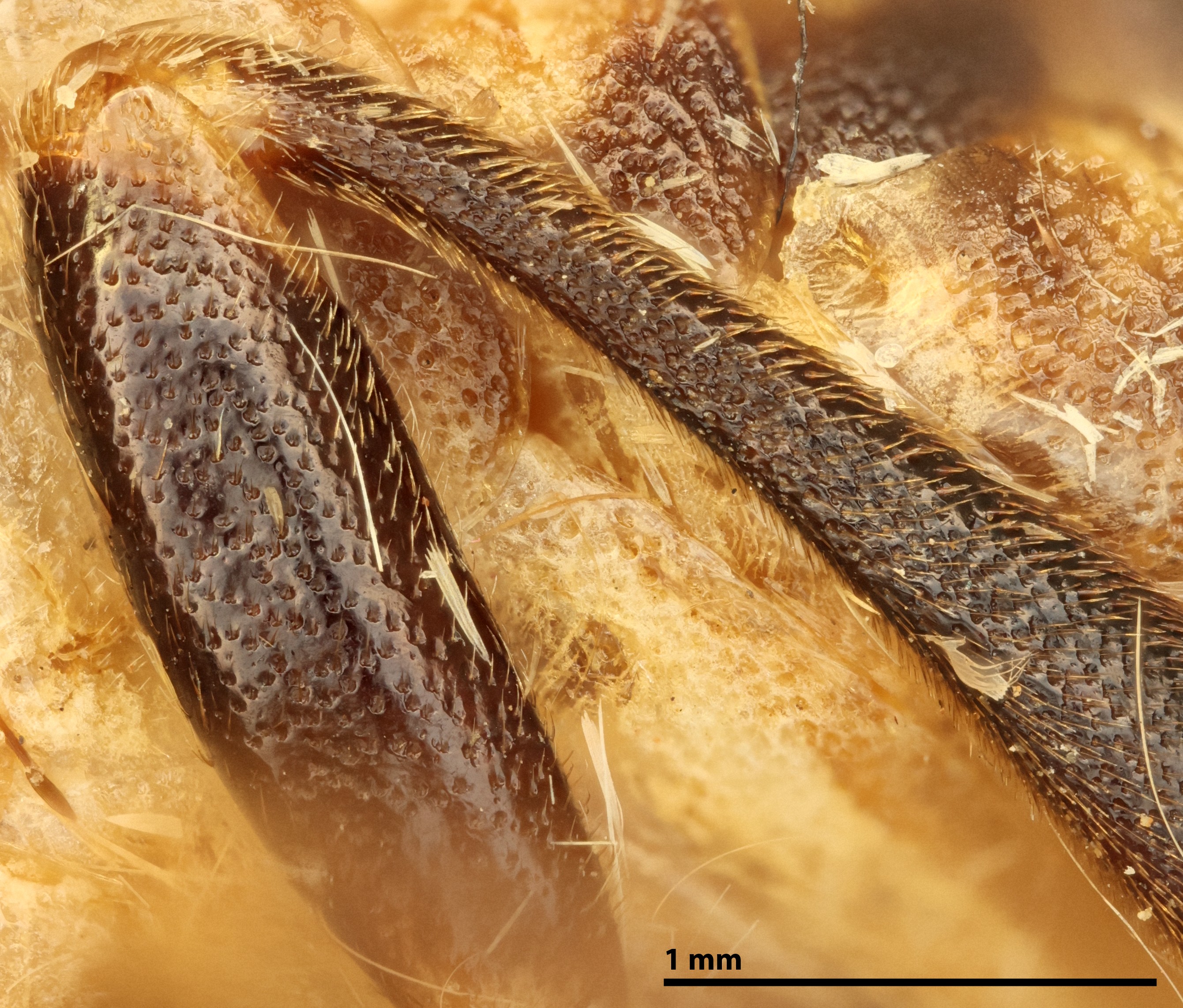 Metafemur and metatibia, female