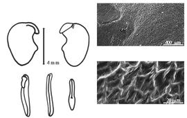  Cotyledon, embryo, and testa:  B. ebenus  (C. Linnaeus) A.P. de Candolle - embryo, cotyledons, and testa SEMs.
