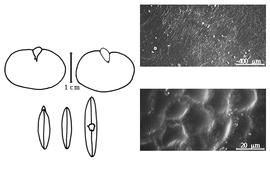  Cotyledon, embryo, and testa:  C. blanchetianum  E.L.R. Tulasne - embryo, cotyledons, and testa SEMs.
