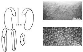  Cotyledon, embryo, and testa:  D. acicularis  J.E. Smith - embryo, cotyledons, and testa SEMs.
