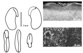  Cotyledon, embryo, and testa:  D. uncinatum  (N. von Jacquin) A.P. de Candolle - embryo, cotyledons, and testa SEMs.
