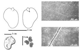  Seed, cotyledon, embryo, and testa:  D. paraensis  G. Bentham var.  macrophylla  (W.A. Ducke) Koeppen - bottom far left seed topography, top left cotyledon investing exposed radicle (L) and embryonic axis (R), bottom left center seeds, testa SEMs.
