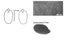  Seed, cotyledon, embryo, and testa:  D. excelsa  W.A. Ducke - left cotyledon concealing only margin of radicle (L) and embryonic axis (R), bottom right seed, testa SEM.
