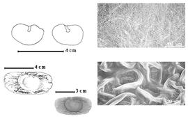  Seed, cotyledon, embryo, and testa:  D. aurantiaca  E.L.R. Tulasne subsp.  epunctata  (E.L.R. Tulasne) H.C. de Lima - top left cotyledon notched investing exposed radicle (L) and embryonic axis (R), bottom far left seed topography, bottom left center seed, testa SEMs.
