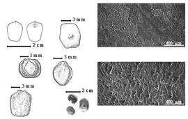  Seed, cotyledon, embryo, and testa:  E. burkei  G. Bentham - left center seed topography, top far left cotyledon concealing radicle (L) and embryonic axis (R), top right testa SEM;  E. elephantina  (Burchell) Skeels - bottom far left seed topography;  E. suffruticosa  H. Schinz - top left center seed topography; bottom right testa SEM;  E.  spp. - far left center seed topography, bottom left center seeds.
