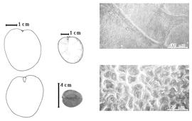  Seed, cotyledon, embryo, and testa:  E. usambarense  H.A.T. Harms - far left cotyledon notched and split and concealing all but tip of radicle (above) and embryonic axis (below), top left center seed topography, bottom left center seed, testa SEMs.
