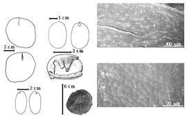  Seed, cotyledon, embryo, and testa:  E. duckeana  R.S. Cowan - top left center cotyledon entire and concealing radicle (L) and embryonic axis (R);  E. falcata  J.B.C.F. Aublet - bottom far left cotyledons split and concealing radicle (L) and embryonic axis (R);  E. glabriflora  (W.A. Ducke) R.S. Cowan - testa SEMs;  E. jenmanii  D. Oliver - top far left cotyledons split and concealing radicle (above) and embryonic axis (below), bottom left center seed;  E. purpurea  G. Bentham - left center cotyledons with partial testa.
