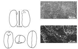  Cotyledon, embryo, and testa:  E. stricta  W. Roxburgh - embryo, cotyledons, and testa SEMs.
