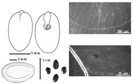  Seed, cotyledon, embryo, and testa:  F. albida  (Delile) A.J.B. Chevalier - top left cotyledon concealing all but tip of radicle (L) and embryonic axis (R), bottom left seed topography, bottom left center seeds, testa SEMs.
