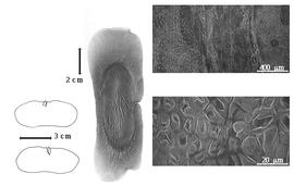  Seed, cotyledon, embryo, and testa:  F. discophora  H.A.T. Harms - left cotyledon not concealing radicle (upper) and embryonic axis (lower), center seed, and testa SEMs.
