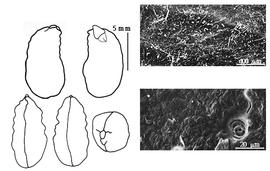  Cotyledon, embryo, and testa:  G. decorticans  (J. Gillies ex W.J. Hooker & G.A.W. Arnott) A.E. Burkart - testa SEMs;  G. spinosa  N. von Jacquin - embryo and cotyledons.
