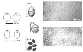  Seed, cotyledon, embryo, and testa:  G. sinensis  J.B.A.P. de M. de Lamarck - top left cotyledons auriculate and concealing all but tip of radicles (L) and embryonic axis (R);  G. triacanthos  C. Linnaeus - bottom left cotyledons auriculate and concealing all but tip of radicles (L) and embryonic axis (R), top left center and left center seed topographys, testa SEMs;  G.  spp. - bottom left center seeds.
