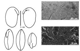  Cotyledon, embryo, and testa:  G. max  (C. Linnaeus) E.D. Merrill - embryo, cotyledons, and testa SEMs.
