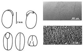  Cotyledon, embryo, and testa:  G. medicagnea  F.J.H. von Mueller - embryo, cotyledons, and testa SEMs.
