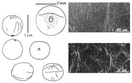  Cotyledon, embryo, and testa:  H. balansae  M. Micheli - embryo, cotyledons, magnification, and testa SEMs.
