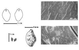  Seed, cotyledon, embryo, and testa:  J. purpurea  W.A. Ducke - top left cotyledon cordate and investing radicle (L) and embryonic axis (R), bottom far left seeds, bottom left center seed topography, testa SEMs.
