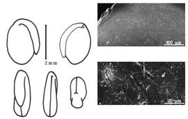  Cotyledon, embryo, and testa:  K. stipulacea  (C.J. Maximowicz) T. Makino - embryo, cotyledons, and testa SEMs.
