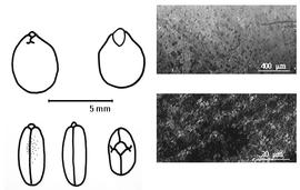  Cotyledon, embryo, and testa:  L. fruticosum  G. Bentham - embryo, cotyledons, and testa SEMs.
