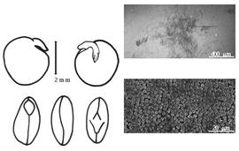  Cotyledon, embryo, and testa:  L. ervoides  (G. de Brignoli di Brunnhoff) L. Grande - embryo, cotyledons, and testa SEMs.
