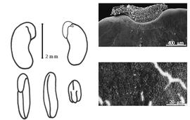  Cotyledon, embryo, and testa:  L. congesta  G. Bentham ex J.G. Baker - embryo, cotyledons, and testa SEMs.
