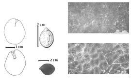  Seed, cotyledon, embryo, and testa:  L. kalantha  H.A.T. Harms - far left cotyledon notched and split and concealing all but tip of radicle (above) and embryonic axis (below), top left center seed topography, bottom left center seed, testa SEMs.
