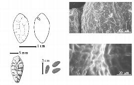  Seed, cotyledon, embryo, and testa:  N. madagascariense  Drake del Castillo - top left cotyledon notched and radicle exposed (L) and embryonic axis (R), bottom far left seed topography, bottom left center seeds, testa SEMs.
