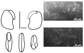  Cotyledon, embryo, and testa:  N. verdcourtii  D. Isely - embryo, cotyledons, and testa SEMs.
