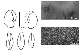  Cotyledon, embryo, and testa:  O. melanotricha  P.E. Boissier - embryo, cotyledons, and testa SEMs.
