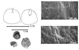  Seed, cotyledon, embryo, and testa:  P. lomentifera  A.E. Burkart - top left cotyledons concealing all but radicle tip (L) and embryonic axis (R), bottom left seeds, testa SEMs.
