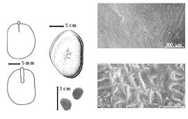  Seed, cotyledon, embryo, and testa:  P. emarginatus  (Hutchinson & Dalziel) J.J.G. Léonard - far left cotyledon notched and split and concealing all but tip of radicle (above) and embryonic axis (below), top left center seed topography, bottom left center seeds, testa SEMs.
