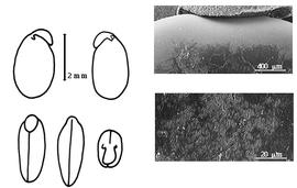  Cotyledon, embryo, and testa:  P. formosum  J.E. Smith - embryo, cotyledons, and testa SEMs.
