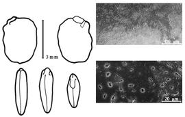  Cotyledon, embryo, and testa:  P. glaegeoides  É.P. Ventenat - embryo, cotyledons, and testa SEMs.
