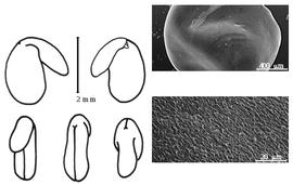  Cotyledon, embryo, and testa:  P. pallens  C.H. Stirton - embryo, cotyledons, and testa SEMs.
