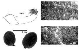  Fruit, seed, and testa:  P. dinklagei  H.A.T. Harms - top left fruit, bottom left seeds, testa SEMs.
